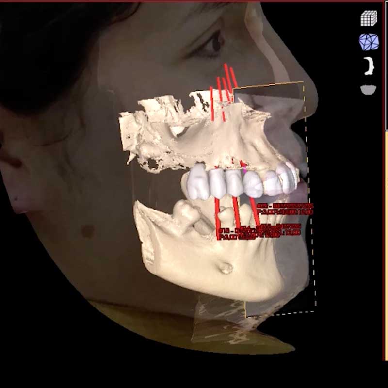 escaner-facial-3d