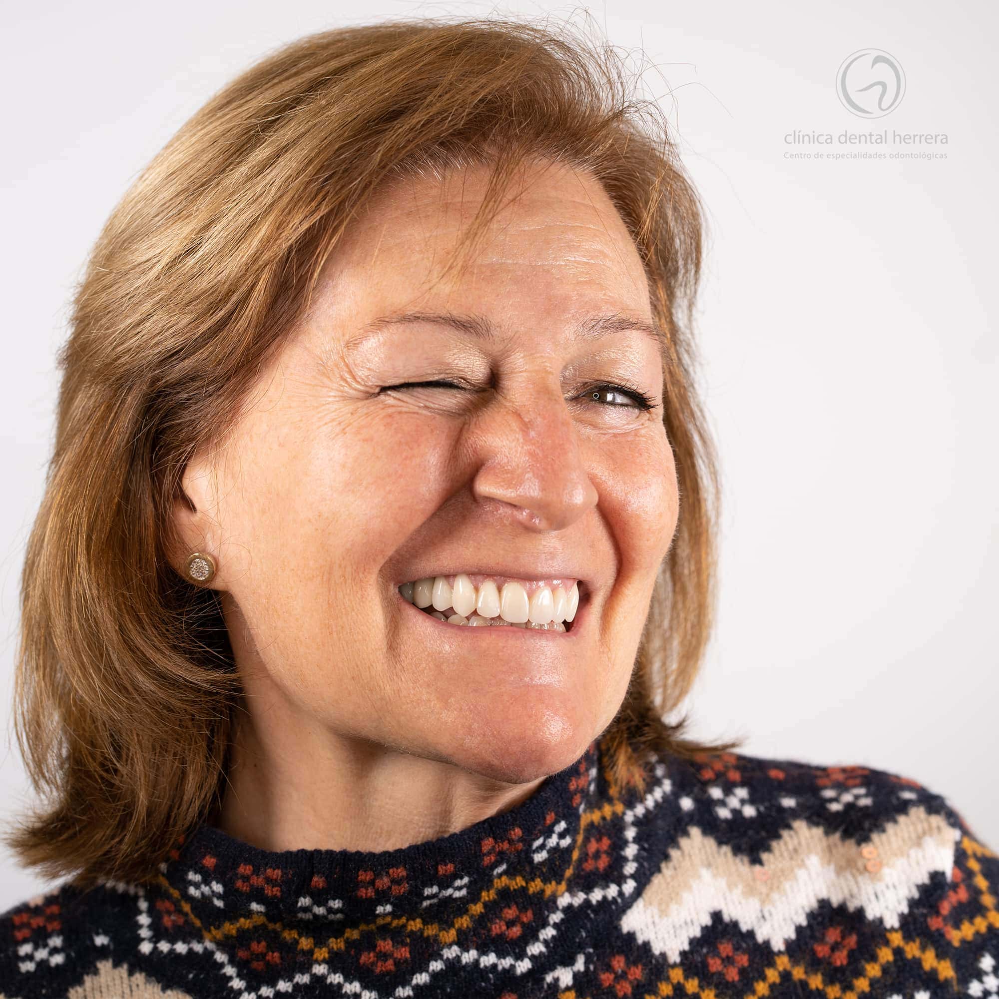 María Molina. Ortodoncia, Implants dentaires et facettes 2