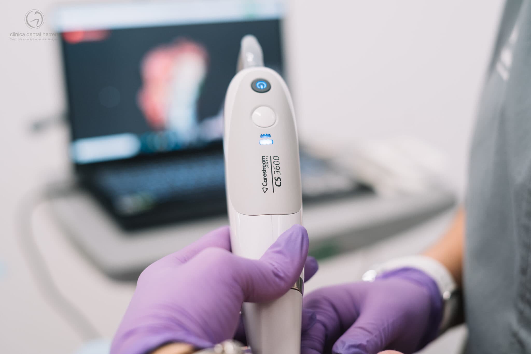 Clínica Dental Herrera perfecciona las impresiones digitales con la dotación de nuevos-escáneres intraorales