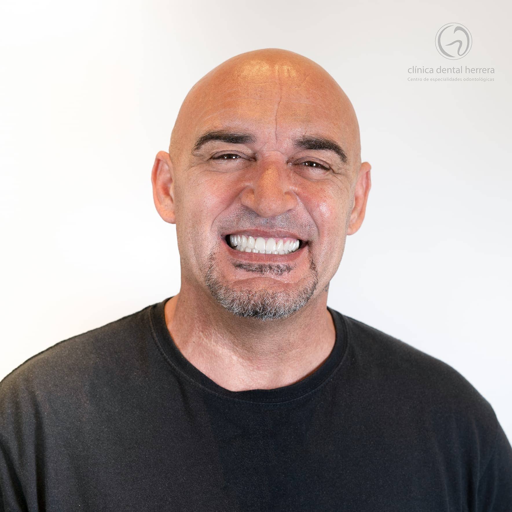Jose Luis Capote. Réhabilitation buccale : implants dentaires et facettes 46